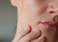 بهترین سرم های آبرسان برای پوست خشک و دهیدارته