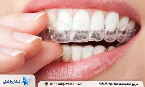 جدیدترین تکنولوژی‌ها در ارتودنسی؛ گامی بزرگ به‌سوی لبخند مدرن