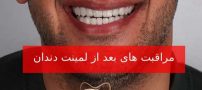 مراقبت های بعد از لمینت دندان برای ماندگاری همیشگی لبخند شما