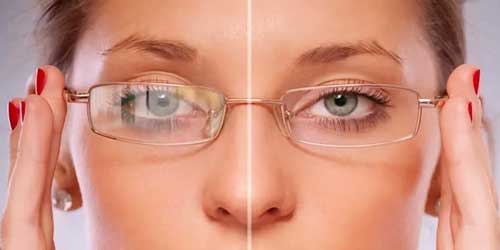 تفاوت عدسی بلوکات و آنتی رفلکس؛ راهنمای کامل انتخاب عدسی مناسب چشم