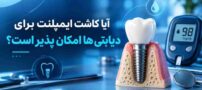 آیا کاشت ایمپلنت برای دیابتی ها امکان پذیر است؟