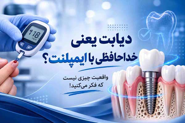 آیا کاشت ایمپلنت برای دیابتی ها امکان پذیر است؟