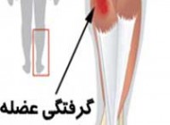 چرا عضلات می گیرند؟