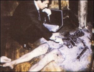 مردی بسیار عجیب که بدنش خود به خود آتش گرفت + عکس