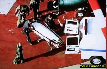 مرگ ملکه زیبایی و مدل مشهور بر اثر جراحی زیبایی +عکس