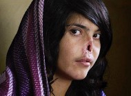 تصویر این دختر 18 ساله معروفترین عکس سال 2011