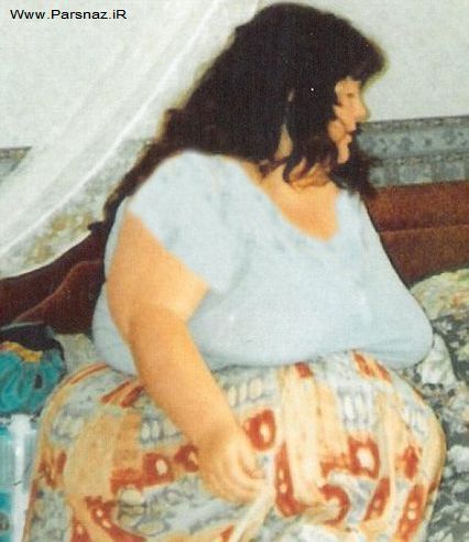 این زن 300 کیلویی برترین زن در زمینه لاغری شناخته شد