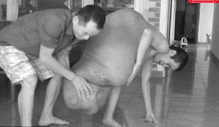 عمل جراحی 12 ساعته یک تومور باورنکردنی + عکس
