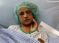 شکنجه دختری که نمیخواست تن فروشی کند + عکس