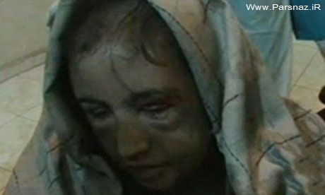 شکنجه دختری که نمیخواست تن فروشی کند + عکس