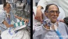 اولین انسانی در جهان که قلب ندارد!! + عکس
