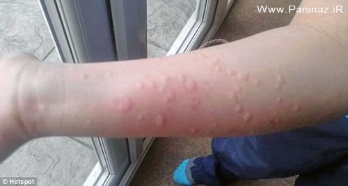 عکس العمل عجیب و مرگبار یک دختر در مقابل سرما + عکس