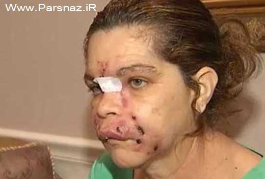 این خانم آمریکایی می خواست زیباتر شود اما + عکس