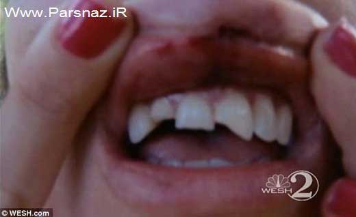 کتک زدن و برهنه کردن این زن توسط پلیس آمریکا (+عکس)