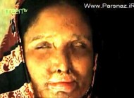 قربانی اسید پاشی مجبور به ازدواج با شوهر خیانتکارش شد