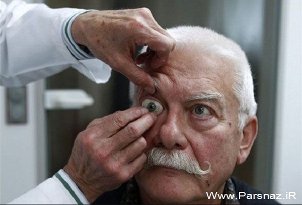 ساخت چشم‌ های مصنوعی توسط این پیرمرد (عکس)