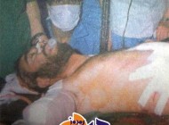 عکس کمیاب وقتی دست شهید خرازی قطع شد
