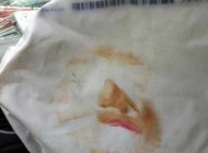 دختری که کل صورتش روی ایربگ پاشیده شد (عکس)