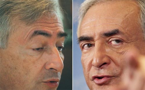 عکس های جنجالی از جراحی زیبایی سیاستمداران