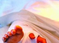 انتقال عضوهای جالب و عجیب (عکس)