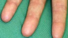 این خانم عجیب اثر انگشت ندارد (عکس)