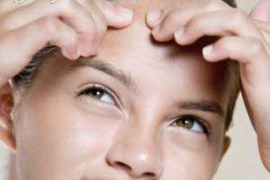 جوش های صورت خود را دستکاری نکنید (سلامت پوست)