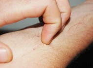 علت هایی که باعث خارش پوست می شود؟