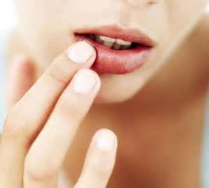با لب‌ های خشک و ترک خورده چه کنیم؟