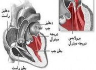 خطرات جانی افتادگی دریچه قلب