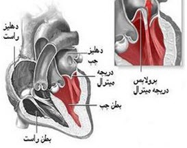 خطرات جانی افتادگی دریچه قلب