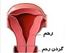 علت زخم دهانه رحم برای خانم ها