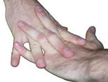 وقتی شما انگشتان خود را می شکنید، چه چیزی باعث ایجاد صدا می شود؟