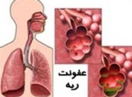 بیماری های مرتبط با عفونت ریه را بشناسید
