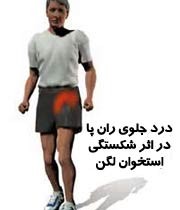 تمرین هایی جهت  پیشگیری از شکستگی استخوان لگن