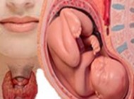 آیا کم کاری تیروئید در بارداری مشکل ساز می شود؟