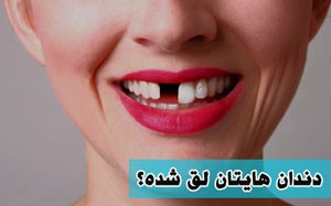 راه درمان دندان لق