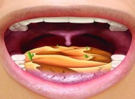راهی برای خلاصی خشکی دهان