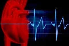 ممکن است وسط ورزش سکته کنید؟