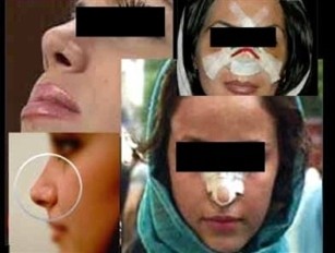 تصاویر وحشتناک از جراحی بینی