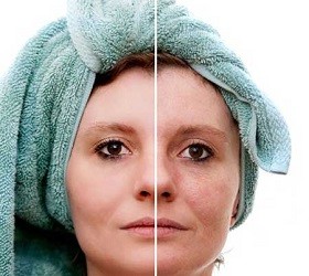 کمپرس صورت چگونه است؟
